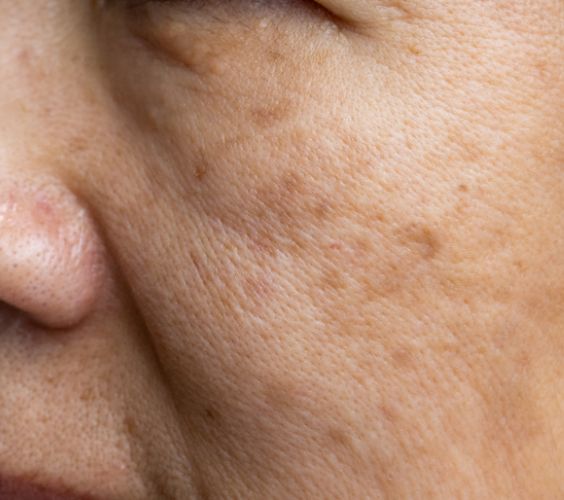 Integrated Pigment Management Integrated Pigment Management
