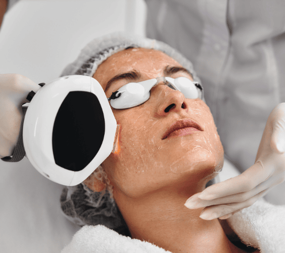 Pigmentation, Melasma & Redness Pigmentation Melasma Redness