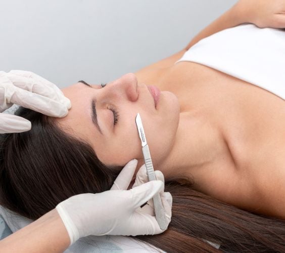 dermaplaning dermaplaning